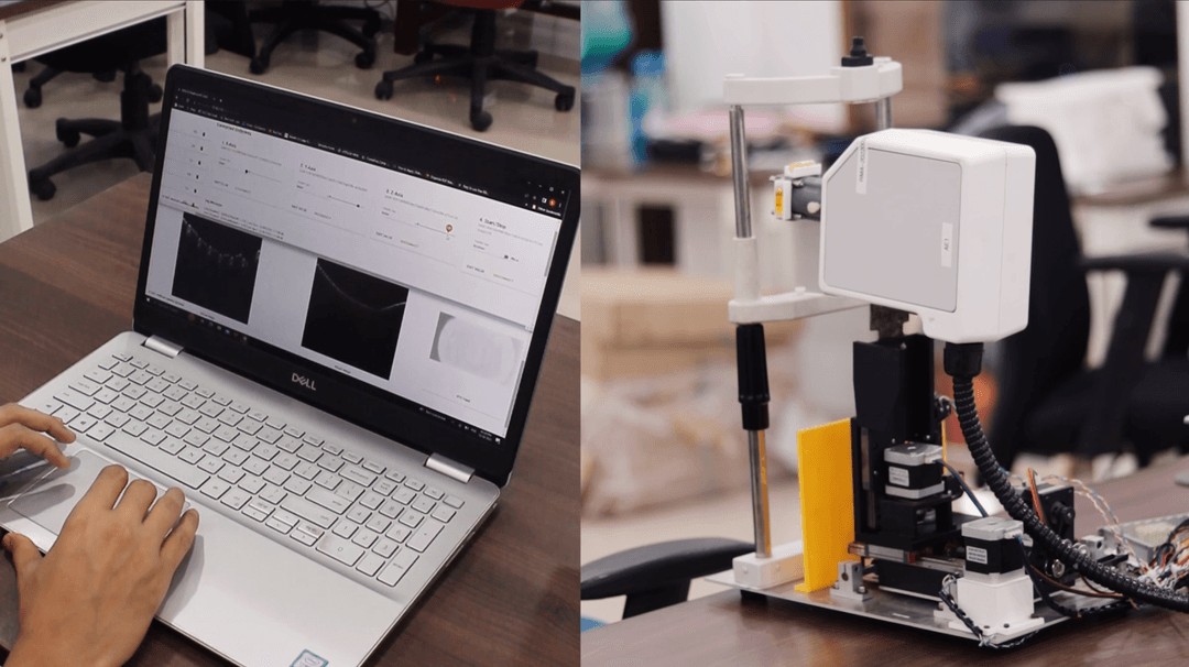 5g enabled world's first AI-enabled portable OCT