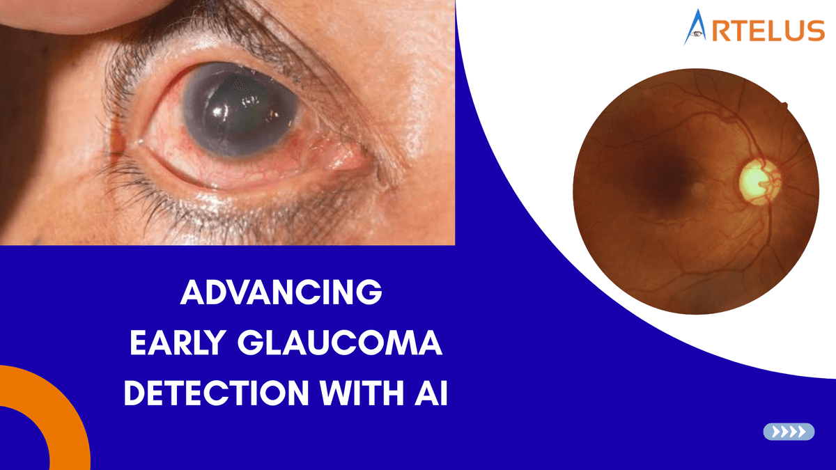Detecting Glaucoma Through AI: Advancing Early Diagnosis and Preventing Vision Loss