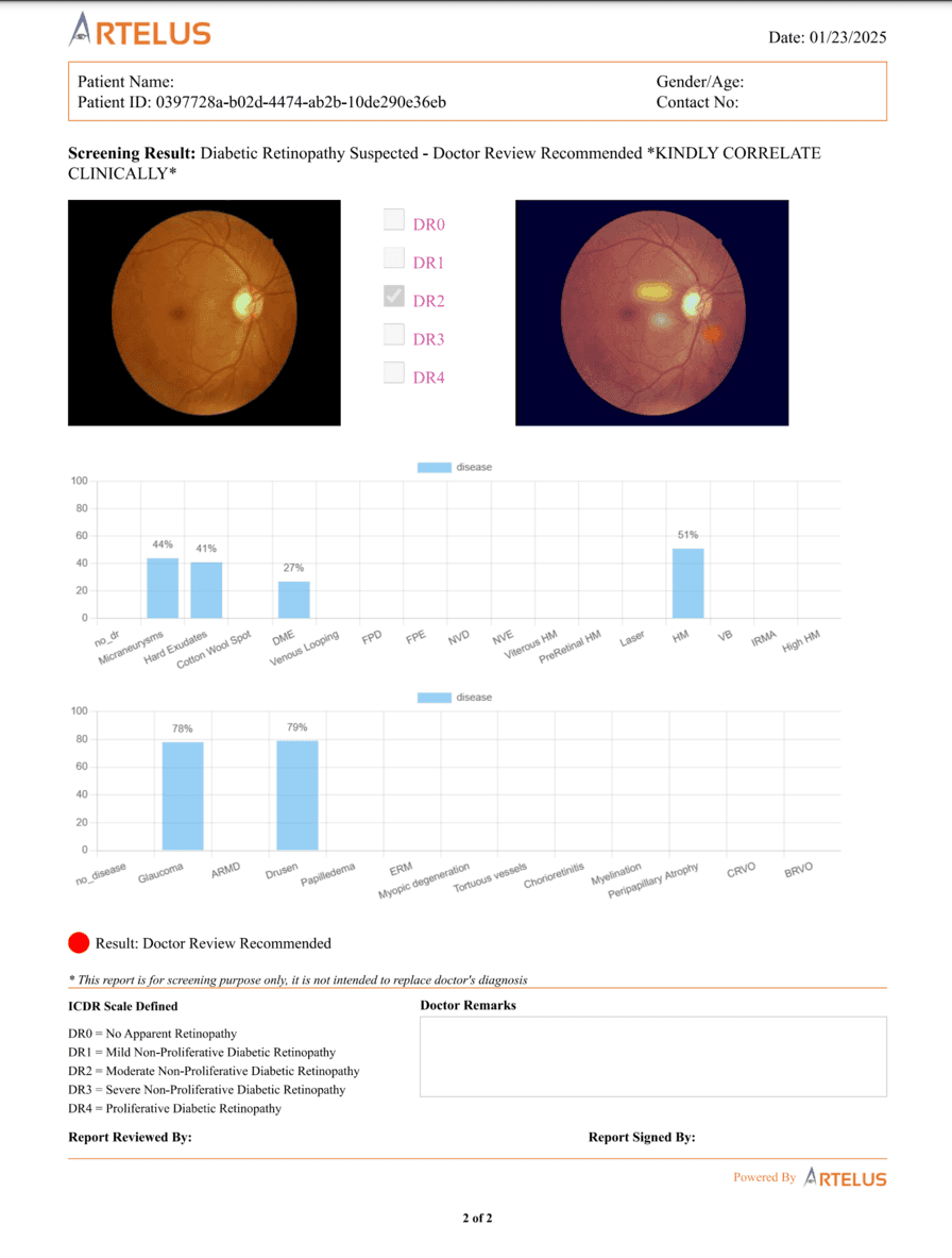 Artelus Diabetic Retinopathy Report - Fundus Image