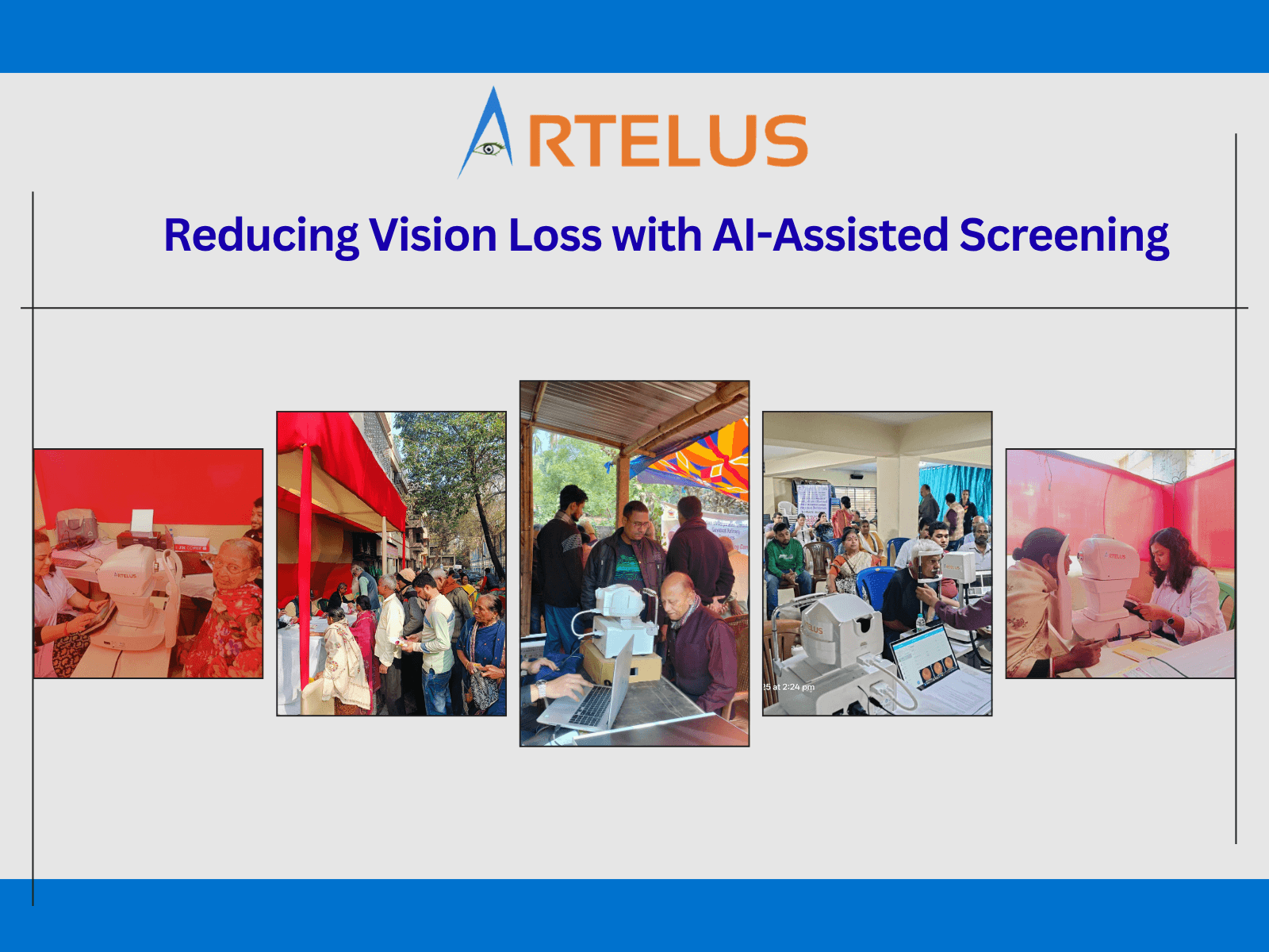 Made in India Solutions for Scalable Diabetic Retinopathy Screening for the Forgotten Billions