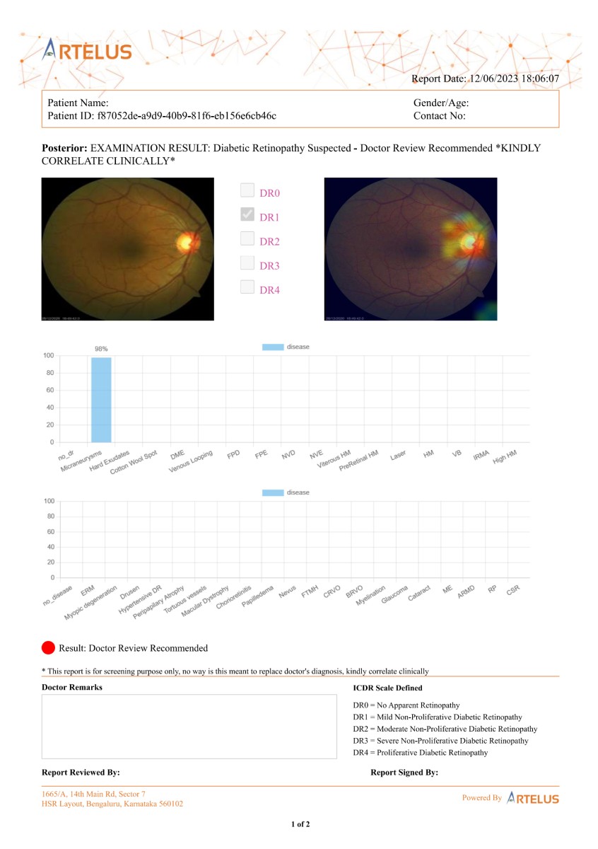 Early case of Diabetic Retinopathy, detected by Artelus' AI model