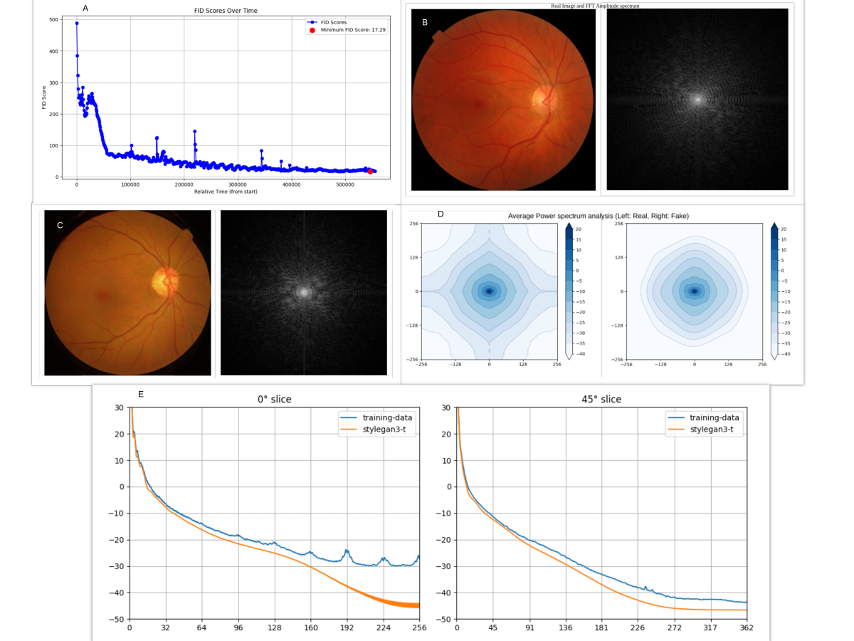 Artelus Diabetic Retinopathy GAN model results