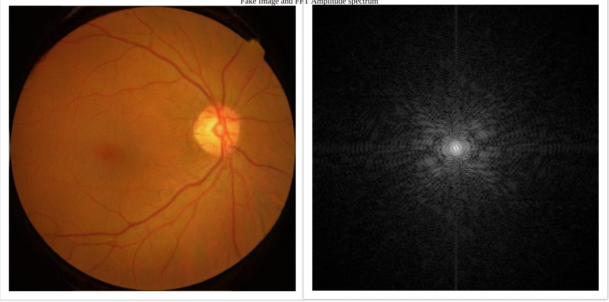 Artelus Diabetic Retinopathy GAN model spectral analysis